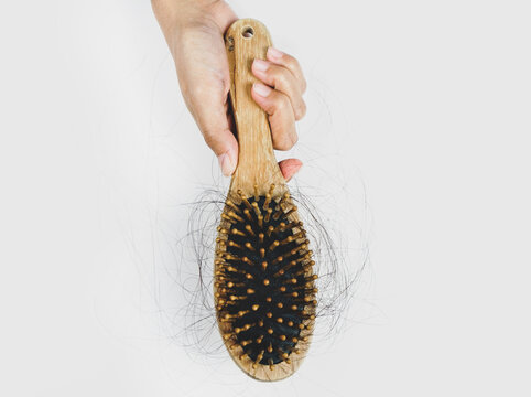 Woman Losing Hair On Hairbrush In Hand, Soft Focus.