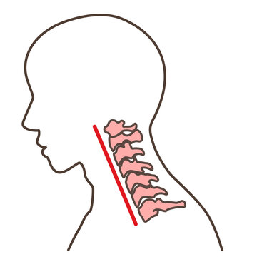 ストレートネック の画像 321 件の Stock 写真 ベクターおよびビデオ Adobe Stock