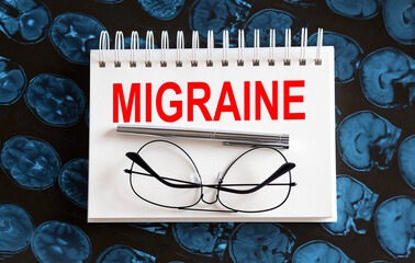 Text MIGRAINE on a mri background. Nearby are various medicines. Medical concept.