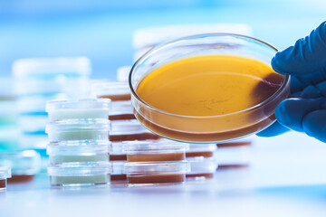 Petri dishes in the microbiology laboratory of a medical clinic