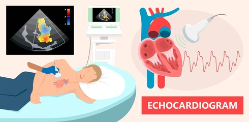 Cath Lab Atrial Septal Defect Tetralogy of Fallot Patent Foramen Ovale Mitral Valve Stenosis Heart Attack Ductus Arteriosus Doppler Coronary Artery Disease Congestive Congenital Valvular VSD exam leak