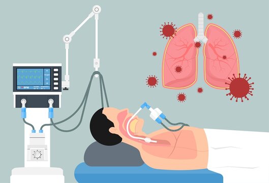 Acute respiratory distress syndrome (ARDS) a respiratory failure and inflammation in the lungs equipment hospital Emphysema fibrosis idiopathic Cystic Collapsed pneumothorax embolism