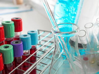 blood tubes on palate and chemical equipment in laboratory. vaccine testing concept