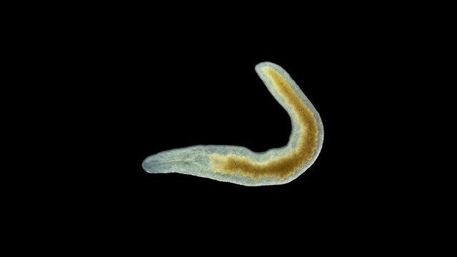 A flatworm of the Prorhynchidae family under a microscope, Order Lecithoepitheliata, sample found at Lake Baikal.