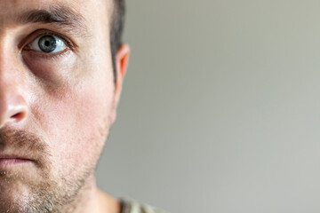 Angry Male Half Face Portrait On Gray Background.