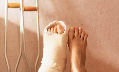 Leg in a cast with crutches against the background of a pink wall..Recovery period after ankle surgery. Close-up. Selective focus. No Edit-Edit