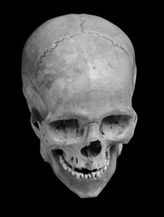 Skull of the human
