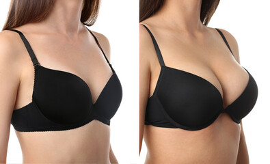Collage of young woman in bra with different sizes of breast on white background. Plastic surgery concept