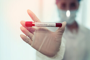 Medical worker holding test tube containing a blood sample that has result positive for coronavirus