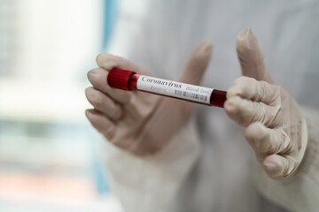 Fototapeta premium female hand hold test tube with blood sample for laboratory testing on analyzing Covid-19
