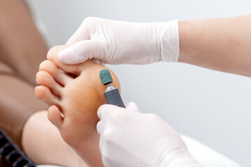 Peeling voeten pedicure procedure van eelt te voet door handen van podotherapeut in witte handschoenen bij schoonheidssalon