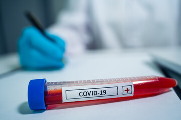 Fototapeta premium Blood sample tube positive with COVID-19 virus