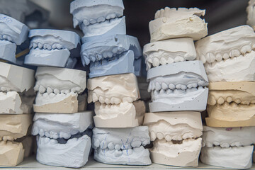 Warehouse of plaster models of human jaws in an orthodontic clinic. Control and diagnostic dental...