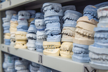 Warehouse of plaster models of human jaws in an orthodontic clinic. Control and diagnostic dental...