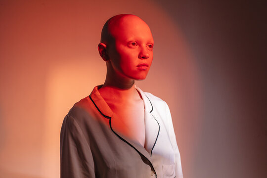 Woman with alopecia in red neon light