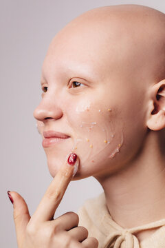 Happy woman with alopecia applying cream on face