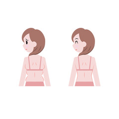 脇と脇腹の肉がはみ出た女性とダイエット後の女性
