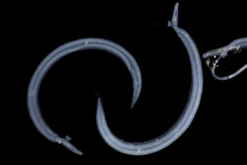 Schistosoma is a genus of trematodes, commonly known as blood flukes under the microscope for...