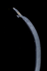 Schistosoma is a genus of trematodes, commonly known as blood flukes under the microscope for education in laboratory.(soft focus and have Grain/Noise )