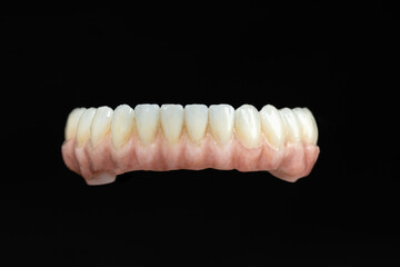 Dental health care. Ceramic zirconium in final version. Close up dental prosthesis on zirconium oxide implants