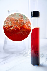 Test Tube Blood Sample