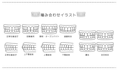 歯科_歯科矯正・歯並び・噛み合わせ白黒
