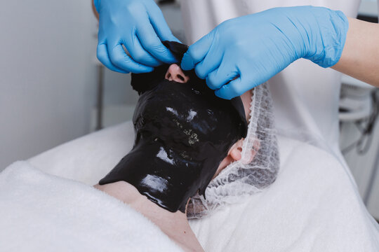 Removing alginate hydration mask from face.