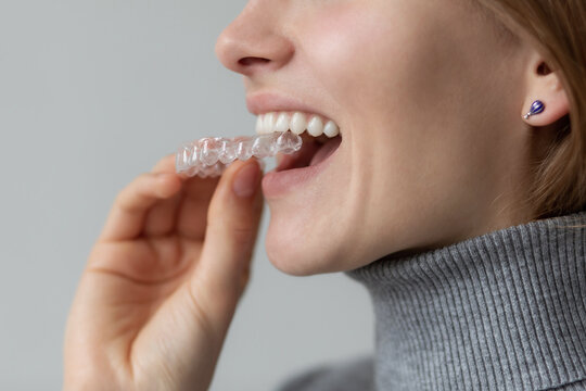 Smiling woman attaching retainer