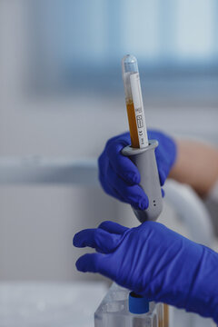 Doctor testing plasma level in organism