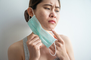 Asian woman worry about acne occur on her face after wearing mask for long time during covid-19...