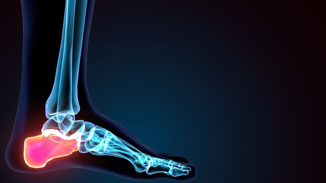 3d illustration of the human skeleton foot calcareous bone 