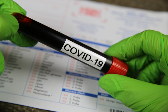 Viersen, Germany - March 22. 2020: Close up of isolated hands with green gloves holding blood sample vial with word covid-19. Blurred lab test request form background.
