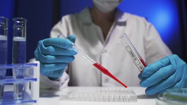 laboratory assistant analyzing a blood sample