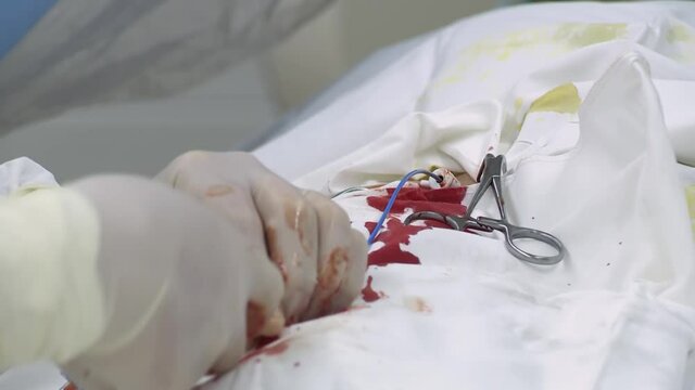 GRODNO, BELARUS - MAY 02, 2018: Head of the angiography Department of the HRODNA regional clinical hospital surgeon conducts a high-tech type of medical care.