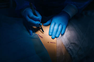 Close up photo of surgeon 's hand hold the scalpel and make inci