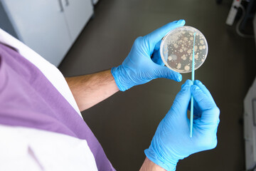 Scientist holding a petri dish with bacterial colonies analyzing microorganisms growth. Laboratory work concept.