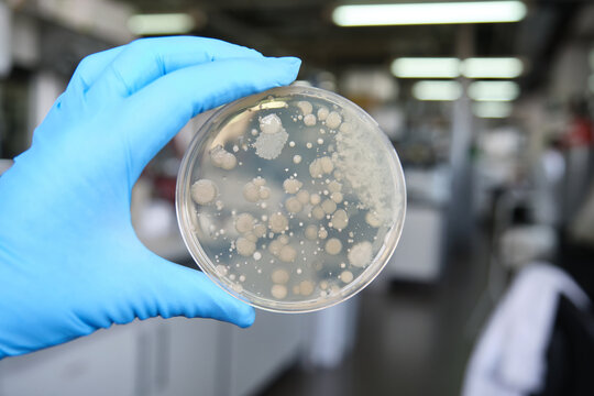Scientist hands holding a petri dish with bacterial colonies. Laboratory routine work concept.