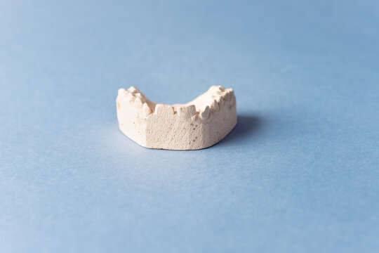 plaster cast of the children's upper jaw on blue background. Correction of bite. copy space. soft focus