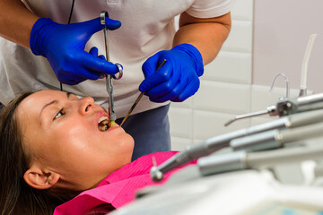 Local anesthesia, dentist carpal syringe injects the patient's gum anesthesia, dental carpule syringe.