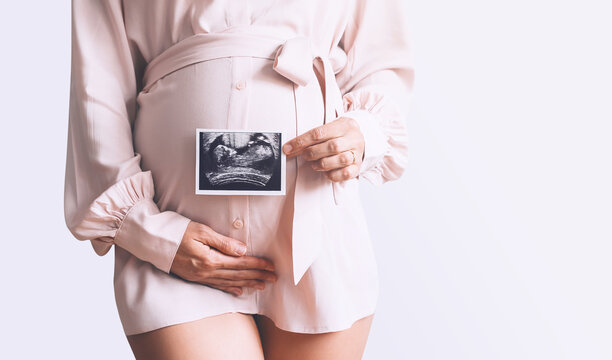 Pregnant woman holding ultrasound baby image.