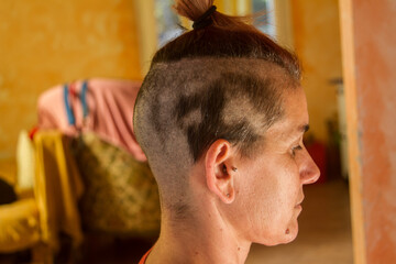 hair loss after chemotherapy on a girl with hair lost or cut to the ground