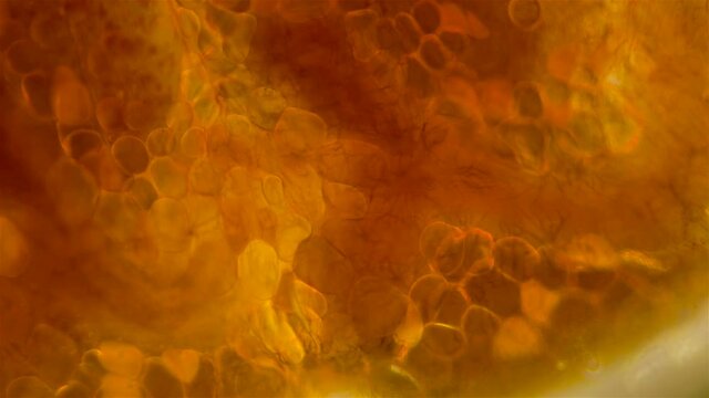 Contraction of the blood vessels of the leech, for the circulation of blood through the body, under a microscope. Hirudinea, class Clitellata. Sample found at Lake Baikal