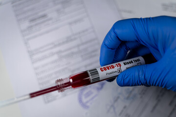 Pipette extracting sample from blood collection tube with positive result for COVID 19. Isolated on background of medical papers. Coronavirus