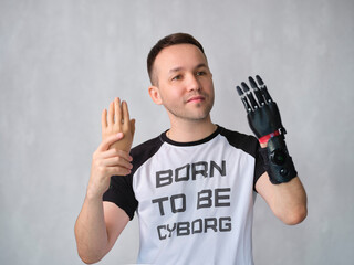 man with bionic Prosthetic Arm