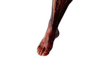 Bleeding human leg isolated on white background.
