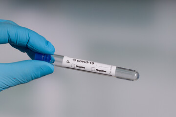 Fototapeta premium close up of a hand in blue gloves holding an empty coronavirus test tube in front of a lab room 