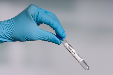 hand in blue gloves holding an empty coronavirus test tube in front of a lab room 