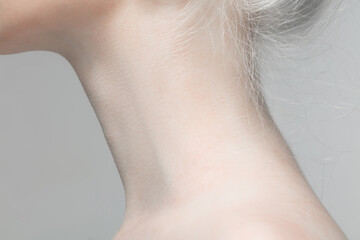 Neck. Close up portrait of beautiful albino female model. Parts of face and body. Beauty, fashion,...