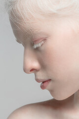 Profile. Close up portrait of beautiful albino female model. Parts of face and body. Beauty,...