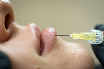 beautician makes an injection on the lips in the face close-up
